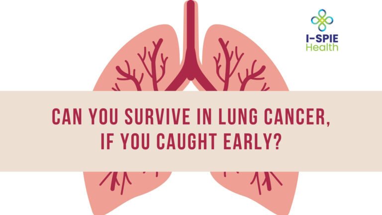 Can You Survive Lung Cancer if Caught Early?